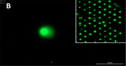 Image of a representative (B) damaged cell, detected by the automated device. (Photo courtesy of Dr. Marcus Cooke)