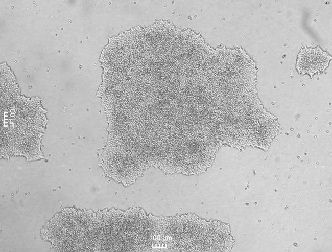 Human stem cell colonies before differentiation. Photo taken at 4X and scale bars represent 100 μm. (Photo courtesy of Stanley Stevens)