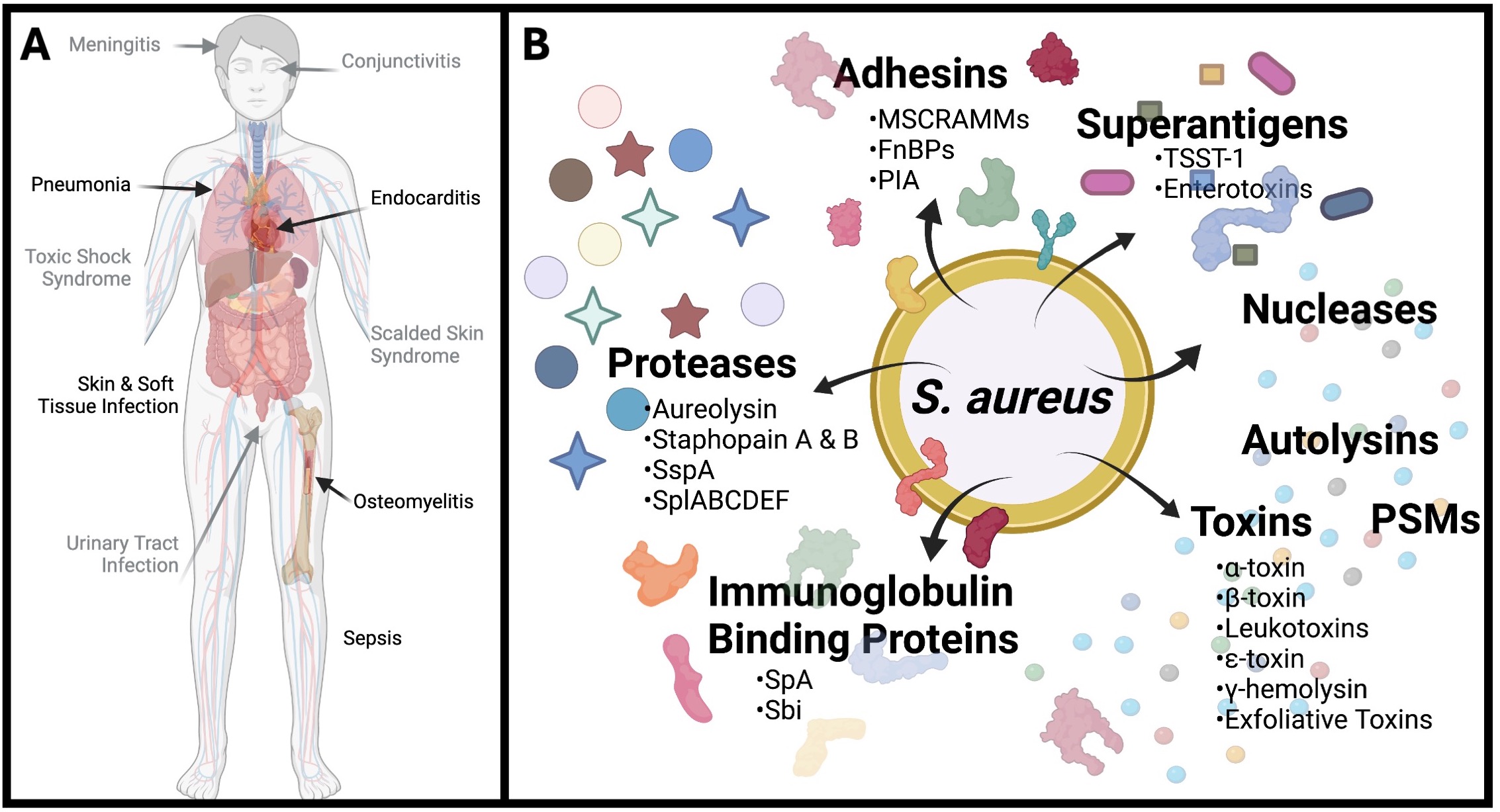 S. aureus Infections