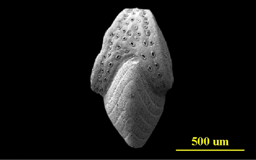 Florida Keys, juvenile apertural view, SEM, X70