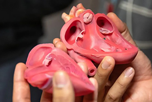 3-D printed heart